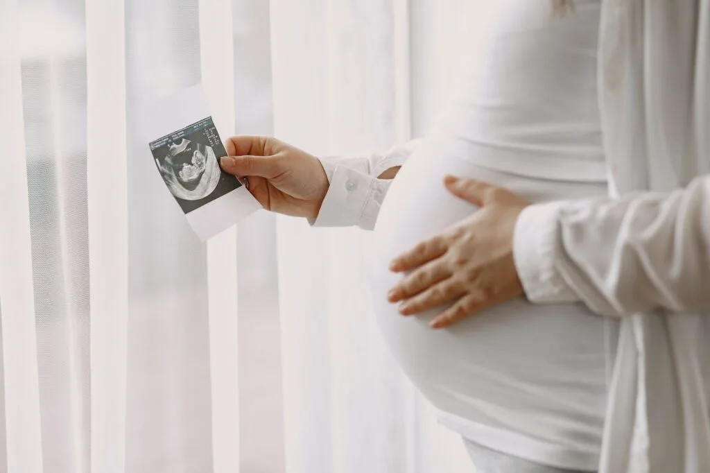 Gestante com a mão na barriga segurando uma foto de ultrassom perto da janela