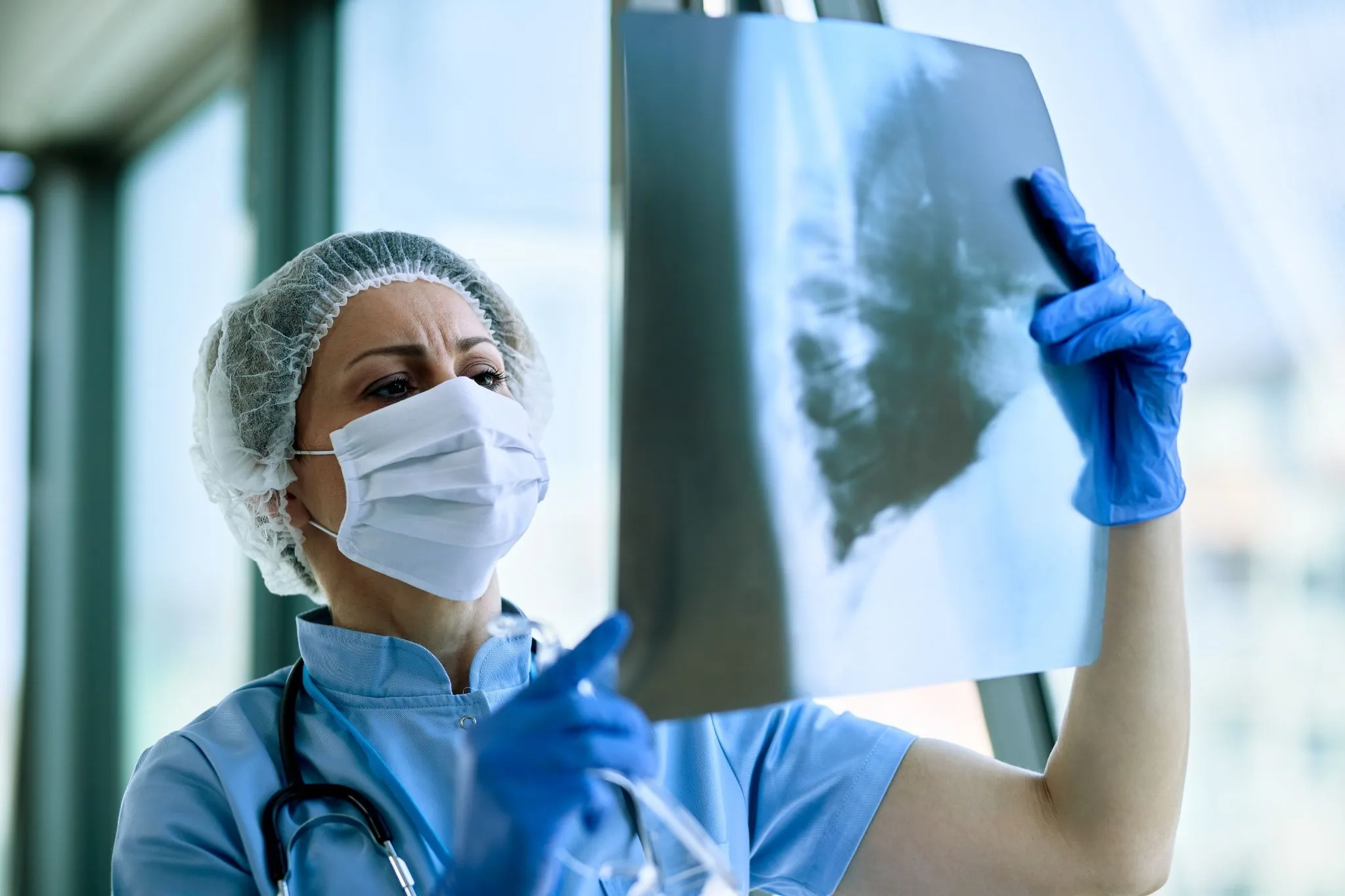 Profissional de saúde com touca e máscara observa uma radiografia de tórax contra a luz